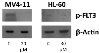 Figure  3:  Genistein  inhibits  the  activation  of  FLT3  protein. 