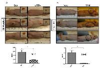 Figure 3:  TR4 increases PPARG null normal prostate epithelial cell tumor formation. 