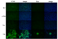 Figure 5:  TR4 increases stem cell population in PPARG null normal prostate epithelial cell. 