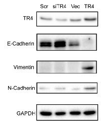 Figure 6:  TR4 increases EMT in PPARG null normal prostate epithelial cell. 