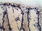 Figure 3B:  IHC staining of Normal colonic mucosa (negative control).