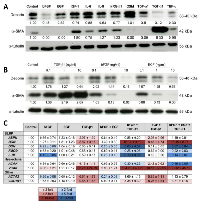 Figure 1: Cytokine treatment influences ECM protein expression in CAFs. 