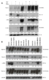 Figure 2:  Treatment of CAFs with combined cytokines  or cancer cell-derived secretomes affects ECM protein  expression. 