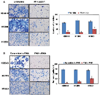 Figure 4: Inhibition of FAK decreases the invasive property of lung cancer cells. 