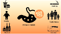 Figure 1: Risk factors for developing stomach cancer.