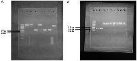 Figure 1: Photograph of agarose gel electrophoresis showing PCR-RFLP of BRCA2 and HOXB13 gene mutation mentioned in Table 1.