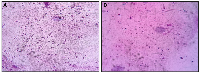 Figure 5: Representative images of semen smears stained with Diff-Quik for sperm morphology assessment at 400&times; magnification.