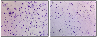 Figure 6: Representative sperm chromatin dispersion (SCD) assay images from infertile male patients were analyzed using a Halosperm&reg; kit and visualized under bright-field microscopy at 400&times; magnification.
